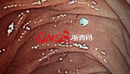 s | ŮӿXÛ]⣬zt(y)Ҳ@w(ni)